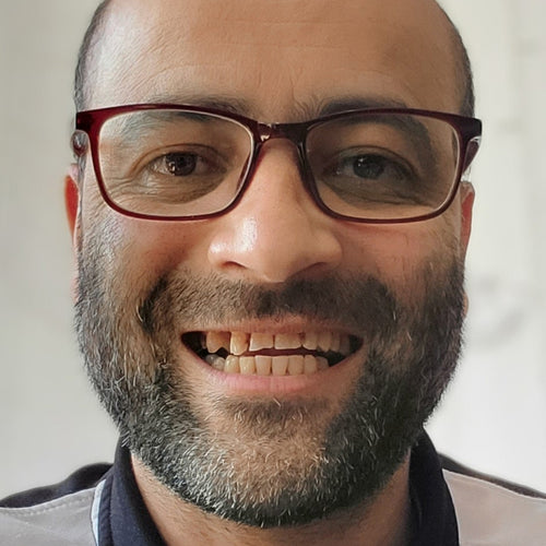 Forme dentali poco armoniose