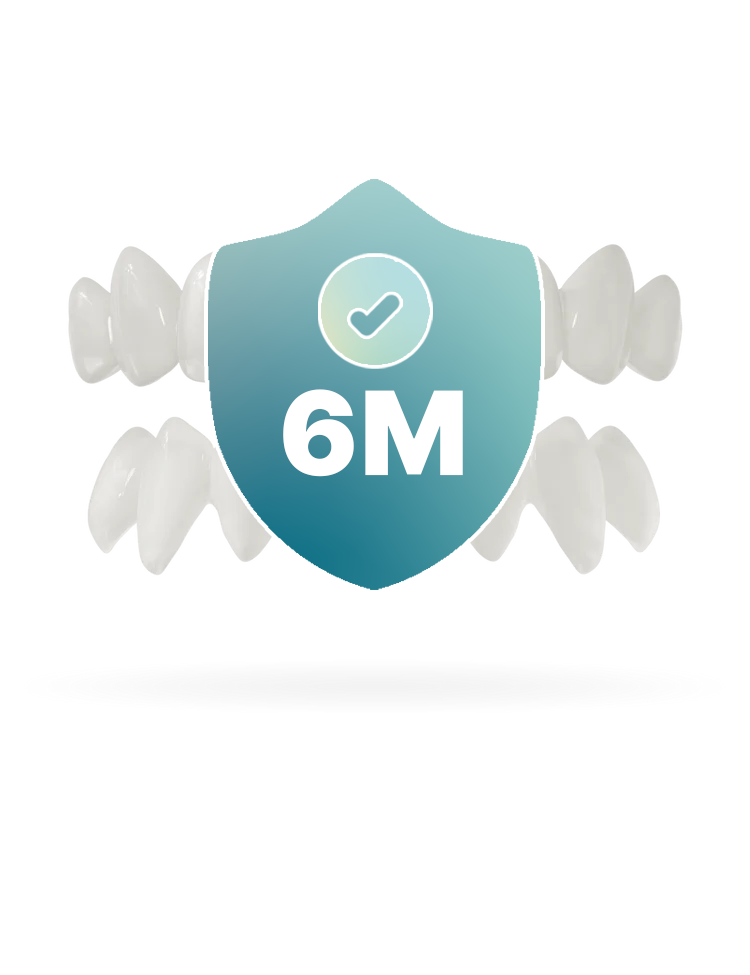 Assicurazione faccette